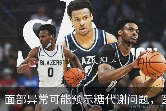 面部异常可能预示糖代谢问题，医生提醒关注五大信号